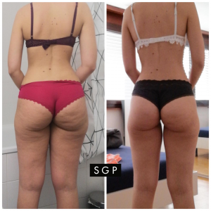 body transformation sgp