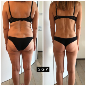 body transformation sgp