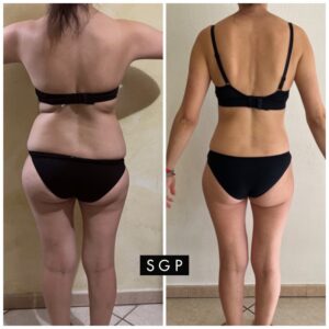 dieta sgp testimonianza