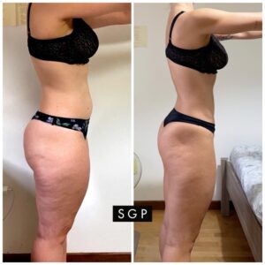 trasformazione sgp glutei addome